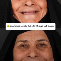 ایمپلنت کامپوزیت دندان لمینت روکش پست عصب کشی|خدمات آرایشگری و زیبایی|مشهد, سجاد شهر|دیوار