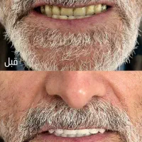 دندانسازی محلات|خدمات آرایشگری و زیبایی|محلات, |دیوار