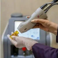 تمدید آف ویژه لیزر کندلا