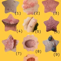 وقت درمان شروع کردنه