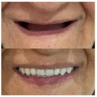 لابراتوار دندانسازی سبز|پزشکی|نسیمشهر, |دیوار