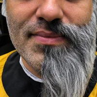 تفاوت ریش و چهره مردا یعنی