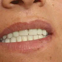 اولین لابراتوار دندانسازی تمام دیجیتال در لردگان