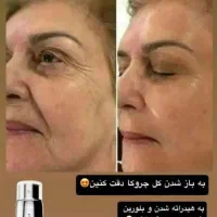 سرم وکرم سه گانه هوشمند