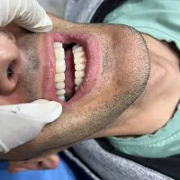 کلینیک تخصصی کامپوزیت و دندان مصنوعی در کرج|خدمات آرایشگری و زیبایی|فردیس, انبار نفت|دیوار