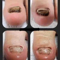 مشکلات ناخن هاتو بمن بسپار