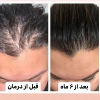 مشاور نمایندگی محصولات لاکچری کوین،ویتابلا|آرایشی، بهداشتی، درمانی|الیگودرز, |دیوار