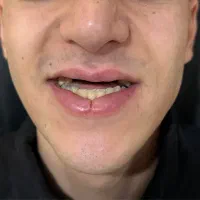 دندان مصنوعی + دندانسازی|خدمات آرایشگری و زیبایی|تهران, شمشیری|دیوار