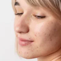 ریتاچ و روتوش و با کیفیت کردن عکس و ادیت ..|خدمات رایانه‌ای و موبایل|سنندج, |دیوار