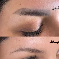 پاک کردن انواع تاتو با لیزر پیشرفته کیوسوئیچ|خدمات آرایشگری و زیبایی|اهواز, کیانپارس |دیوار