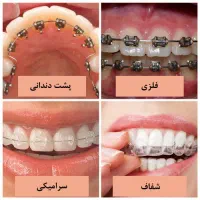 ارتودنسی بدون پیش پرداخت در کلینیک تمام اقساط حامی
