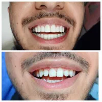 دندانپزشکی.کامپوزیت.ارتودنسی.روکش.عصبکشی|خدمات آرایشگری و زیبایی|کرمانشاه, |دیوار