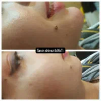 کلیه خدمات زیبائی هم خدمات هم آموزش|خدمات آرایشگری و زیبایی|فاضل آباد, |دیوار