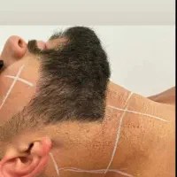 لیزر مو دائمی با دستگاه الکس کندلا اصل آمریکا|خدمات آرایشگری و زیبایی|اصفهان, سعادتآباد|دیوار