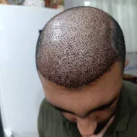 تخفیف ویژه کاشتمو|خدمات آرایشگری و زیبایی|فسا, |دیوار