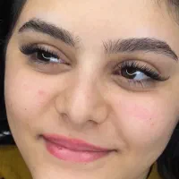 کاشت و اکستنشن مژه