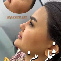 کلینیک زیبایی و لیزر آیسان فیلر و بوتاکس|خدمات آرایشگری و زیبایی|قم, دروازه چوبی|دیوار