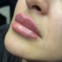 تزریق ژل وبوتاکس و آموزش فیلر با 5سال سابقه کاری|خدمات آرایشگری و زیبایی|جیرفت, |دیوار