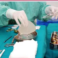 ماموپلاستی و پروتز سینه