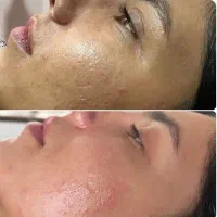 تخفیف آموزش و خدمات فیشال تخصصی بانوان و آقایان|خدمات آرایشگری و زیبایی|مشهد, کوثر|دیوار