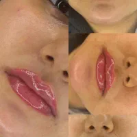 نیازمند مدل رایگان فیلر لب