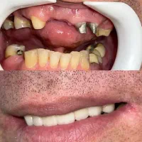 مطب دندانپزشکی در فاضل آباد با شرایط ویژه|خدمات آرایشگری و زیبایی|فاضل آباد, |دیوار
