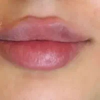 تخفیف ویژه در تمام لاینهای زیبایی|خدمات زیبایی و سلامت|تبریز, |دیوار