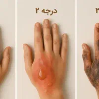 بهترین جراح و کارشناس زخم ایران|خدمات آرایشگری و زیبایی|تهران, جهاد|دیوار