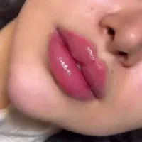 ژل .بوتاکس.انزیم،انواع پرسینگ با بهترین کیفیت.|خدمات آرایشگری و زیبایی|ملایر, |دیوار