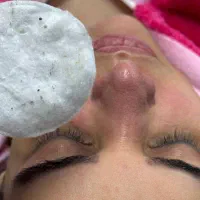 درماپلینیگ درما پاکسازی