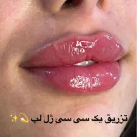 ژل و بوتاکس