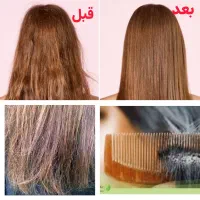 بهبودی مشکلات مو و موخوره
