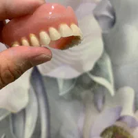 روکش های دندانی(پروتز های دندانی)|خدمات آرایشگری و زیبایی|ارومیه, |دیوار