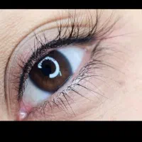 هزینه عمل چشم