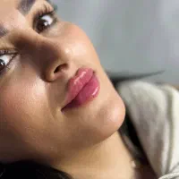 تزریق فیلر فول فس،تزریق فیلر بادی ،تزریق چربی