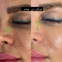 جوانسازی ،درمان پوست ،فیشال،پاکسازی،پوست کره ای|خدمات آرایشگری و زیبایی|شیراز, قدوسی غربی|دیوار