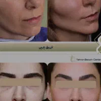 زیبایی/کاشت مو/رفع غبغب/تزریق ژل/ کلینیک در تهران|خدمات آرایشگری و زیبایی|ارومیه, |دیوار