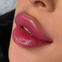 نیازمند به مدل جهت تزریق فیلر لب و صورت