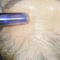 فیشیال تخصصی صورت|خدمات آرایشگری و زیبایی|قم, صدوق|دیوار