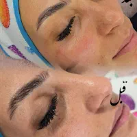 ارائه خدمات فیشال (پاکسازی پوست ) مراقبتی ،درمانی