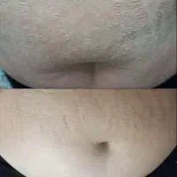 جشنواره بزرگ تخصصی لایه‌برداری و نوسازی پوست