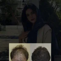 خوشگل شو تضمینی