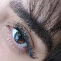 کاشت مژه هیدن یا موقعت