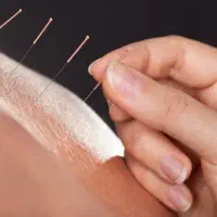 طب سوزنی
