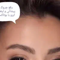 تزریق بوتاکس و ژل در کلینیک(توسط پزشک،)