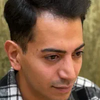 کاشت مو ابرو ریش با بروزترین متددنیا