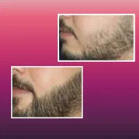 با کم پشتی ریش و سبیلت و موهات خدافظی کن