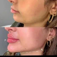 آموزش و انجام خدمات پوست