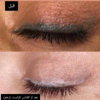 پاک کردن تتو ابرو چشم لب ریموو تضمینی ۱۰۰٪|خدمات آرایشگری و زیبایی|یاسوج, |دیوار