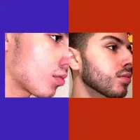 تحولی در چهرت ایجاد کن